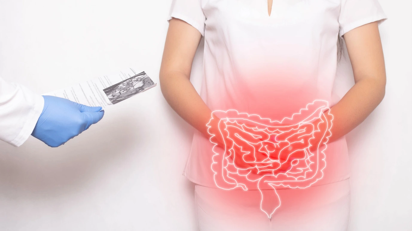 How-to-Treat-Your-Irritable-Bowel